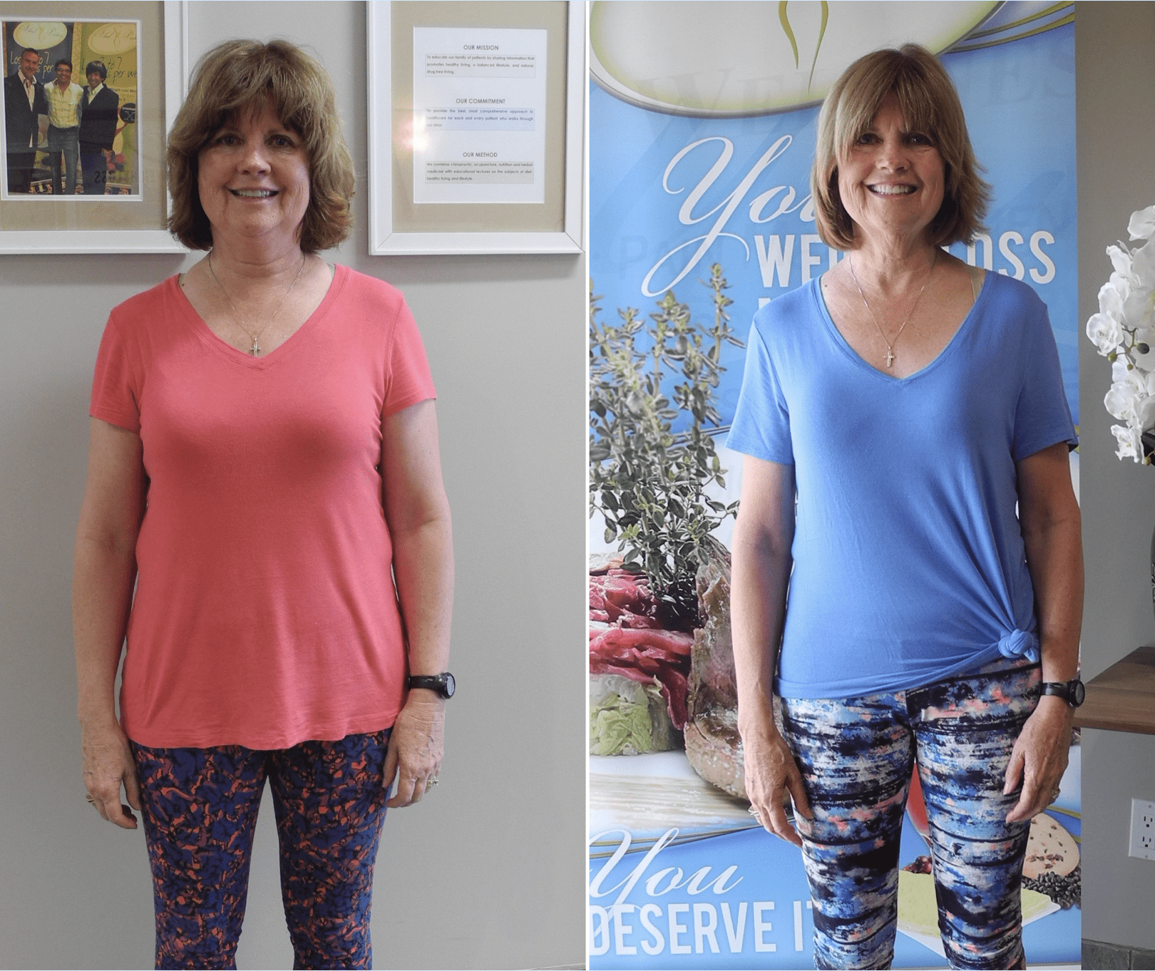 before-after-mary-oldsite