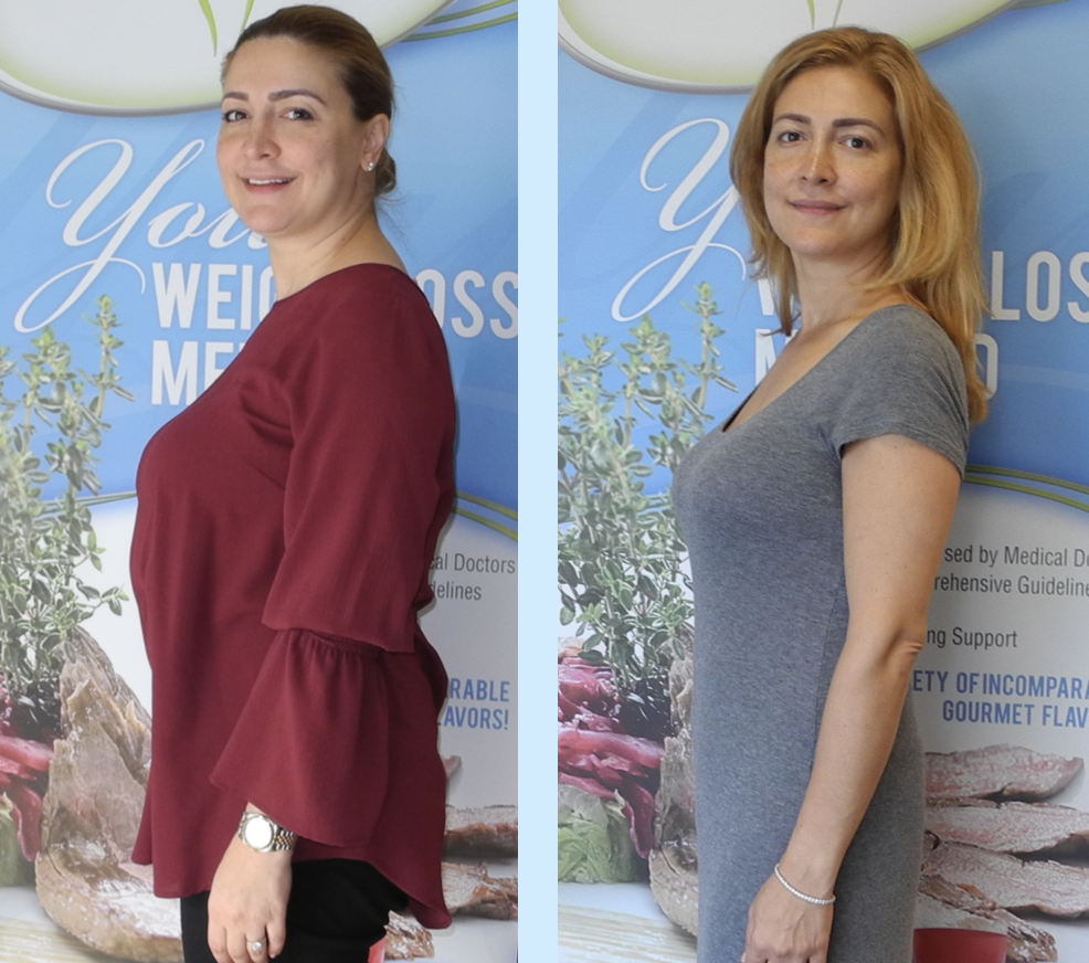 before-after-sanaz-r-oldsite