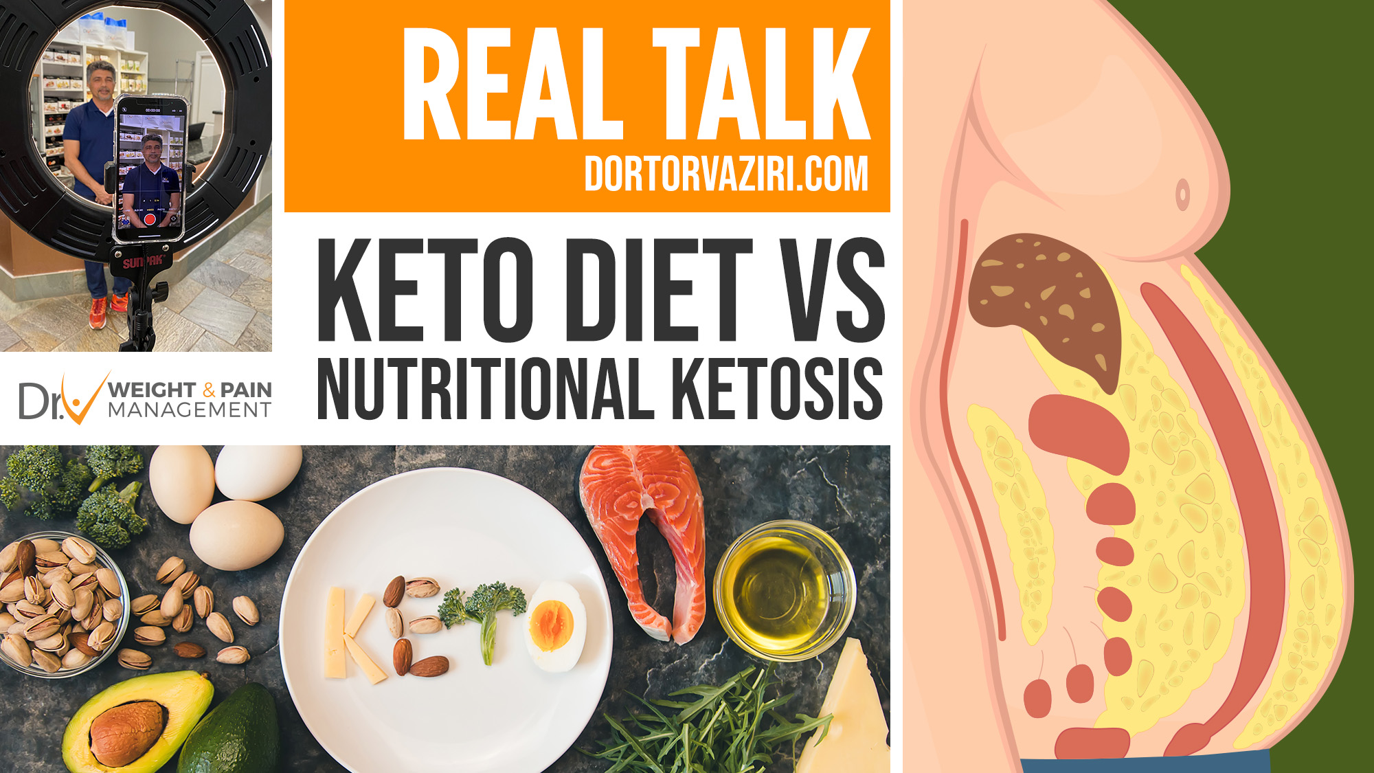 meetup-event-keto-diet-vs-nutritional-ketosis