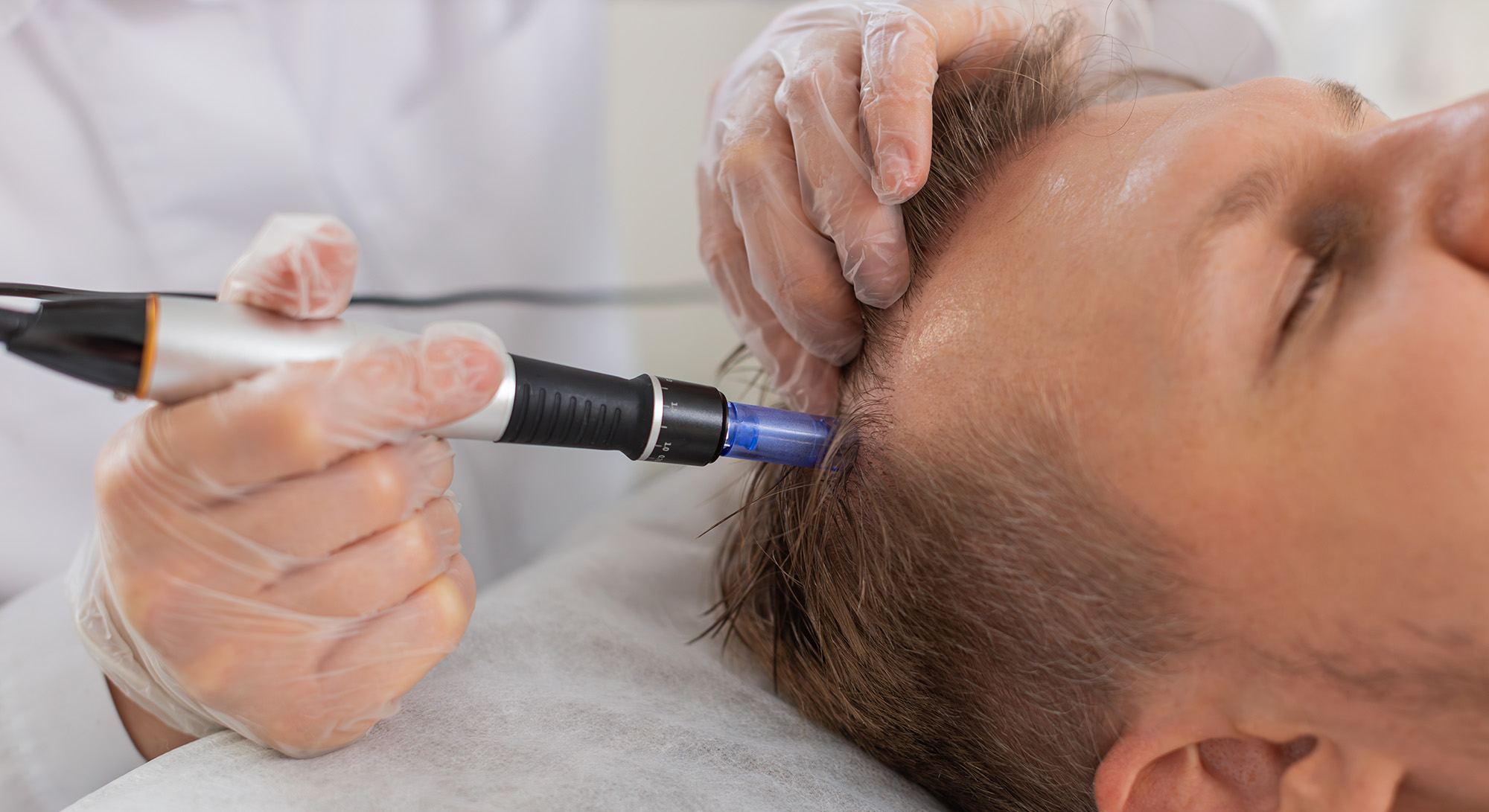 Clinician wearing gloves uses a handheld device on a patient's temple for a scalp treatment while the patient lies down.